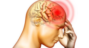 Nuova cura del mal di testa, un rimedio efficace