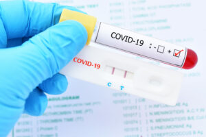 Positive test result by using rapid test device for COVID-19 virus, novel coronavirus 2019 found in Wuhan, China