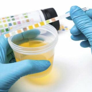 Test antidroga sul lavoro: in cosa consiste e chi lo deve fare